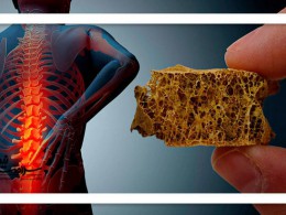 5 خوراکی مؤثر برای جلوگیری از پوکی استخوان